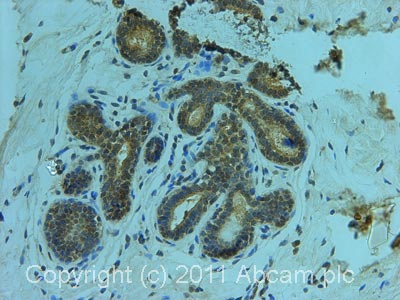 Immunohistochemistry (Formalin/PFA-fixed paraffin-embedded sections) - Anti-alpha Actinin 4 antibody - Cytoskeleton Marker (AB59468), expandable thumbnail