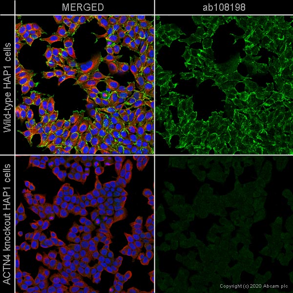 Immunocytochemistry/ Immunofluorescence - Anti-alpha Actinin 4 antibody [EPR2533(2)] (ab108198), expandable thumbnail
