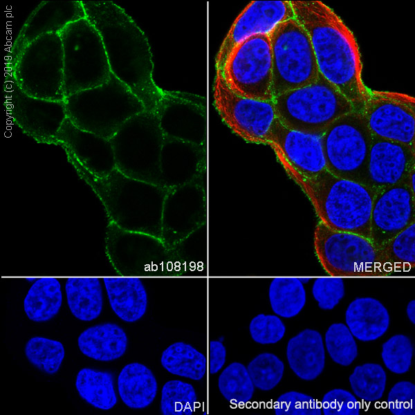 Immunocytochemistry/ Immunofluorescence - Anti-alpha Actinin 4 antibody [EPR2533(2)] (AB108198), expandable thumbnail