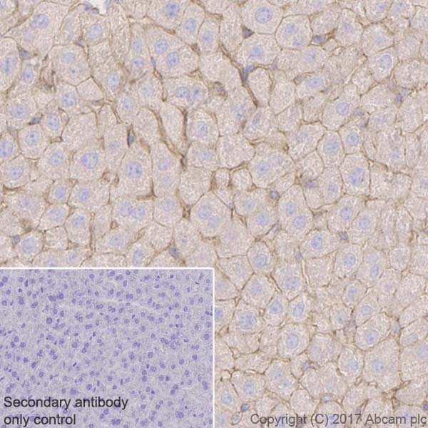 Immunohistochemistry (Formalin/PFA-fixed paraffin-embedded sections) - Anti-alpha Actinin 4 antibody [EPR2533(2)] (ab108198), expandable thumbnail