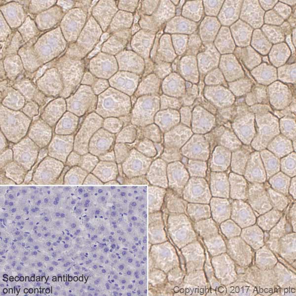 Immunohistochemistry (Formalin/PFA-fixed paraffin-embedded sections) - Anti-alpha Actinin 4 antibody [EPR2533(2)] (AB108198), expandable thumbnail