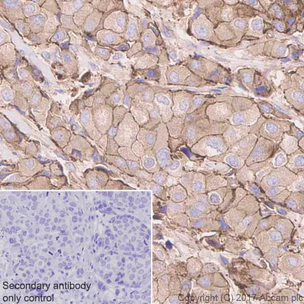 Immunohistochemistry (Formalin/PFA-fixed paraffin-embedded sections) - Anti-alpha Actinin 4 antibody [EPR2533(2)] - Loading Control (AB108198)