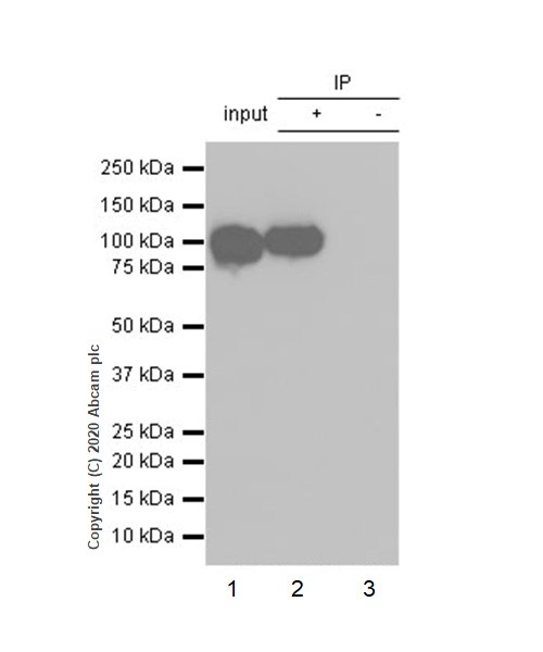 Immunoprecipitation - Anti-alpha Actinin 4 antibody [EPR2533(2)] - Loading Control (ab108198), expandable thumbnail
