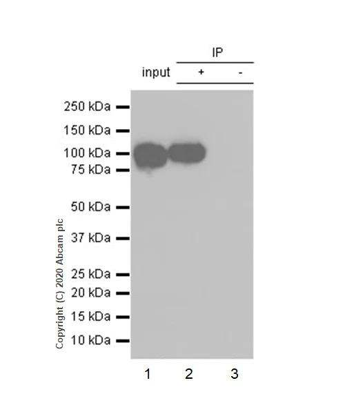 Immunoprecipitation - Anti-alpha Actinin 4 antibody [EPR2533(2)] - Loading Control (AB108198)