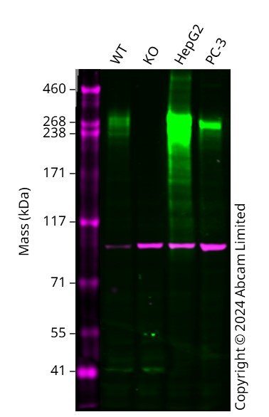 Western blot - Anti-alpha Actinin 4 antibody [EPR2533(2)] - Loading Control (ab108198), expandable thumbnail