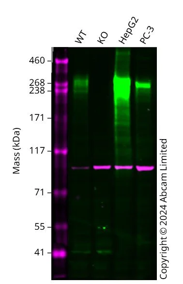 Western blot - Anti-alpha Actinin 4 antibody [EPR2533(2)] - Loading Control (AB108198)