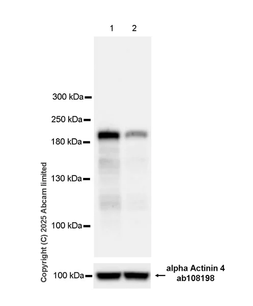 Western blot - Anti-alpha Actinin 4 antibody [EPR2533(2)] - Loading Control (AB108198)