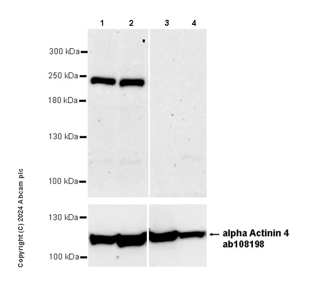 Western blot - Anti-alpha Actinin 4 antibody [EPR2533(2)] - Loading Control (AB108198)