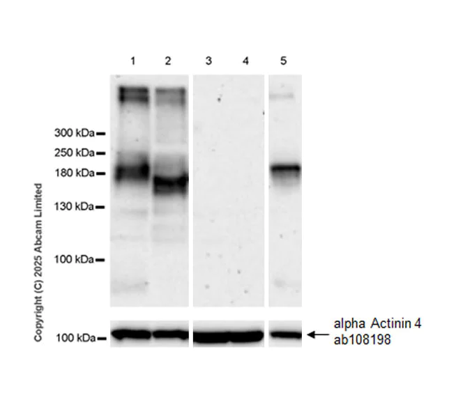 Western blot - Anti-alpha Actinin 4 antibody [EPR2533(2)] - Loading Control (AB108198)