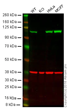 Western blot - Anti-alpha Actinin 4 antibody [EPR2533(2)] - Loading Control (AB108198)