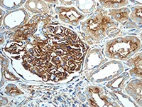 Immunohistochemistry (Formalin/PFA-fixed paraffin-embedded sections) - Anti-alpha Actinin 4 antibody [EPR4410] - BSA and Azide free (AB216448)