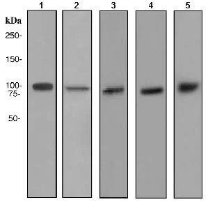 Western blot - Anti-alpha Actinin 4 antibody [EPR4410] - BSA and Azide free (AB216448)