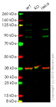 Western blot - Anti-alpha Actinin 4 antibody [EPR4410] - Loading Control (AB108201), expandable thumbnail