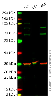 Western blot - Anti-alpha Actinin 4 antibody [EPR4410] - Loading Control (AB108201)