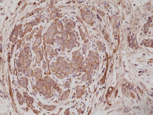 Immunohistochemistry (Formalin/PFA-fixed paraffin-embedded sections) - Anti-alpha Actinin 4 antibody [RM287] - Loading Control (AB222767), expandable thumbnail