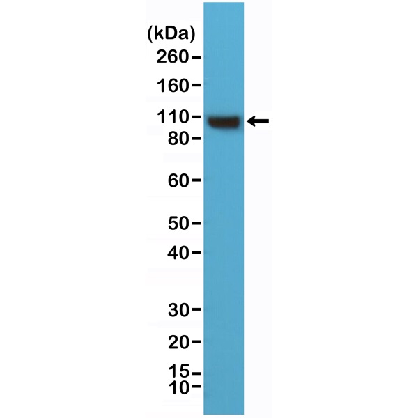 Western blot - Anti-alpha Actinin 4 antibody [RM287] - Loading Control (AB222767), expandable thumbnail