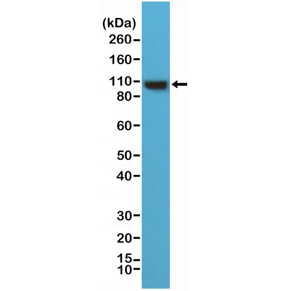 Western blot - Anti-alpha Actinin 4 antibody [RM287] - Loading Control (AB222767)
