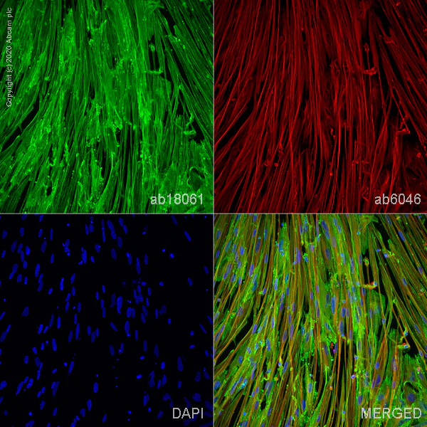 Immunocytochemistry - Anti-alpha Actinin/ACTN1 antibody [AT6/172] - Cytoskeleton Marker (AB18061)