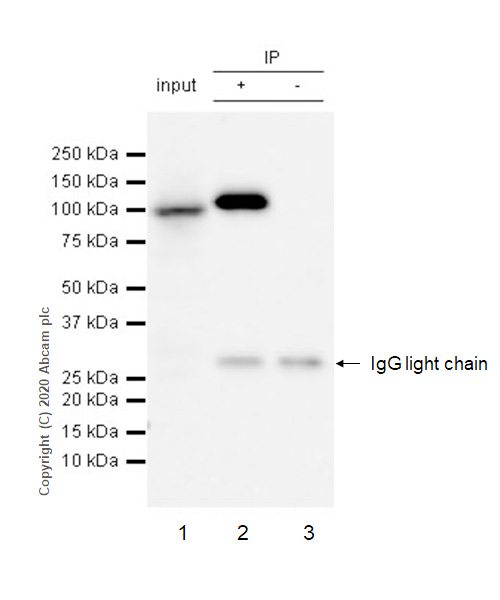 Immunoprecipitation - Anti-alpha Actinin/ACTN1 antibody [EP2527Y] - BSA and Azide free (AB239858)