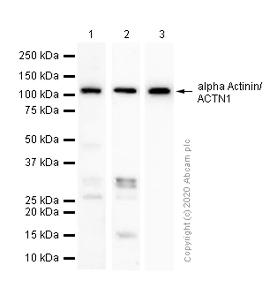 Western blot - Anti-alpha Actinin/ACTN1 antibody [EP2527Y] - BSA and Azide free (AB239858)