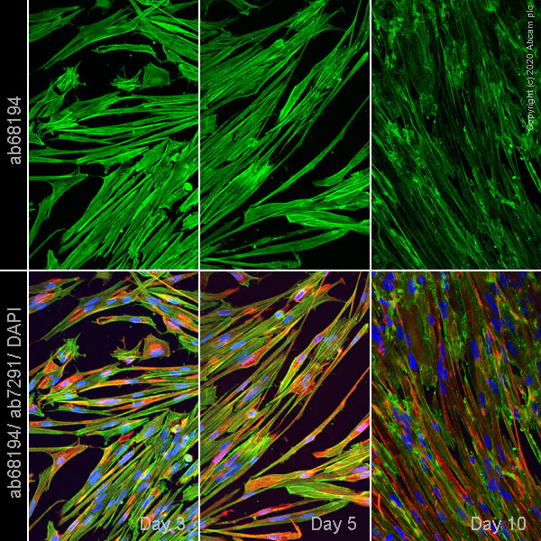Immunocytochemistry/ Immunofluorescence - Anti-alpha Actinin/ACTN1 antibody [EP2527Y] - Loading Control (AB68194)
