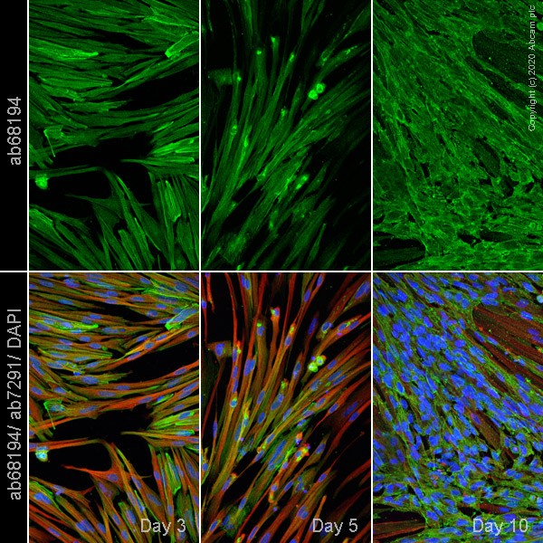Immunocytochemistry/ Immunofluorescence - Anti-alpha Actinin/ACTN1 antibody [EP2527Y] (AB68194), expandable thumbnail