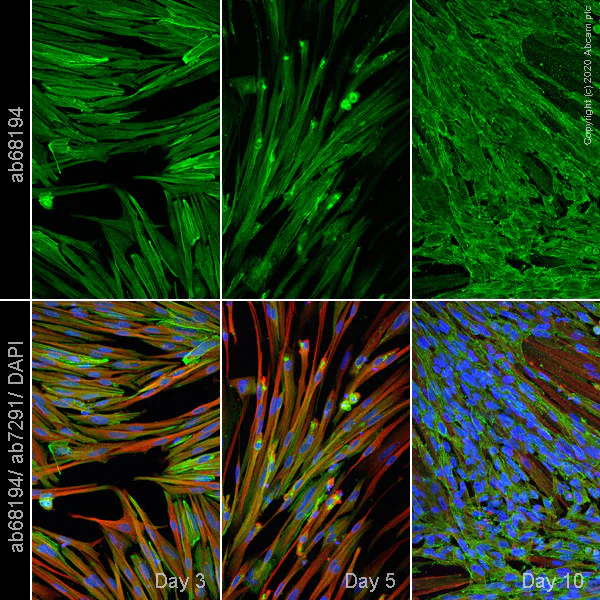 Immunocytochemistry/ Immunofluorescence - Anti-alpha Actinin/ACTN1 antibody [EP2527Y] - Loading Control (AB68194)