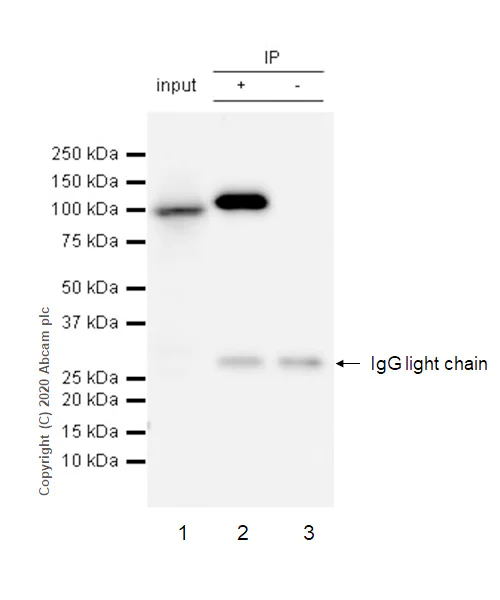 Immunoprecipitation - Anti-alpha Actinin/ACTN1 antibody [EP2527Y] - Loading Control (AB68194)