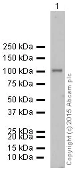 Western blot - Anti-alpha Actinin/ACTN1 antibody [EP2528Y] - BSA and Azide free (AB185204)