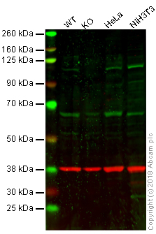 Western blot - Anti-alpha Actinin/ACTN1 antibody [EP2528Y] - Loading Control (AB81265), expandable thumbnail