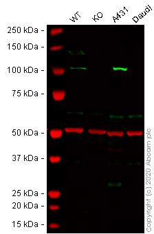 Western blot - Anti-alpha Actinin/ACTN1 antibody [EP2528Y] - Loading Control (AB81265), expandable thumbnail