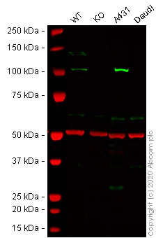 Western blot - Anti-alpha Actinin/ACTN1 antibody [EP2528Y] - Loading Control (AB81265)