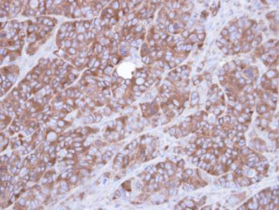 Immunohistochemistry (Formalin/PFA-fixed paraffin-embedded sections) - Anti-alpha Actinin/ACTN1 antibody (AB155480), expandable thumbnail