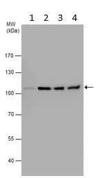 Western blot - Anti-alpha Actinin/ACTN1 antibody - Loading Control (AB155480)