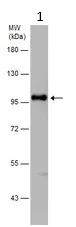 Western blot - Anti-alpha Actinin/ACTN1 antibody - Loading Control (AB155480)