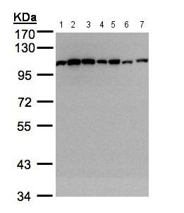 Western blot - Anti-alpha Actinin/ACTN1 antibody - Loading Control (AB155480), expandable thumbnail