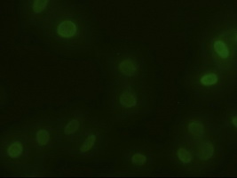 Immunocytochemistry/ Immunofluorescence - Anti-alpha Actinin/ACTN1 antibody [OTI7A4] (AB90421), expandable thumbnail