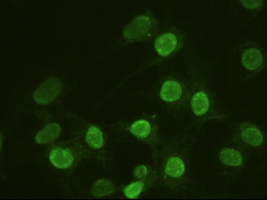 Immunocytochemistry/ Immunofluorescence - Anti-alpha Actinin/ACTN1 antibody [OTI7A4] (ab90421), expandable thumbnail
