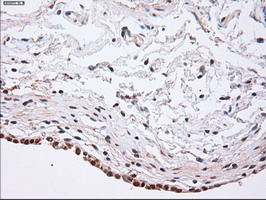 Immunohistochemistry (Formalin/PFA-fixed paraffin-embedded sections) - Anti-alpha Actinin/ACTN1 antibody [OTI7A4] (AB90421), expandable thumbnail