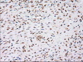Immunohistochemistry (Formalin/PFA-fixed paraffin-embedded sections) - Anti-alpha Actinin/ACTN1 antibody [OTI7A4] (AB90421), expandable thumbnail