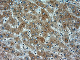 Immunohistochemistry (Formalin/PFA-fixed paraffin-embedded sections) - Anti-alpha Actinin/ACTN1 antibody [OTI7A4] (ab90421), expandable thumbnail