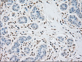 Immunohistochemistry (Formalin/PFA-fixed paraffin-embedded sections) - Anti-alpha Actinin/ACTN1 antibody [OTI7A4] (AB90421), expandable thumbnail