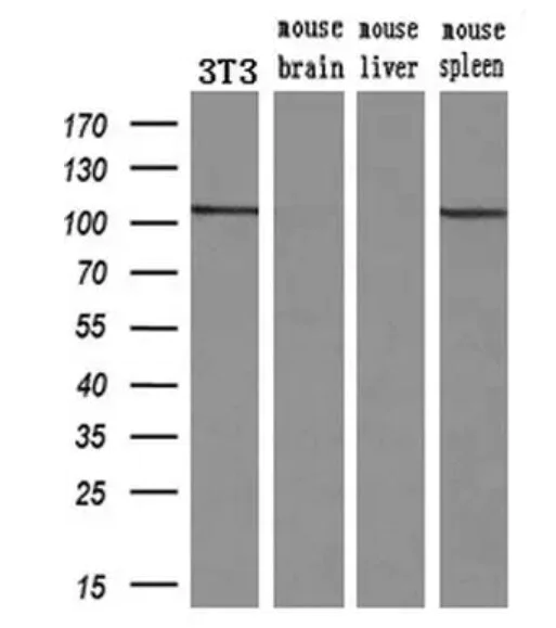 Western blot - Anti-alpha Actinin/ACTN1 antibody [OTI7A4] - Loading Control (AB90421)