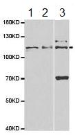 Western blot - Anti-alpha Adaptin antibody (AB186828), expandable thumbnail
