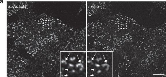 Immunocytochemistry/ Immunofluorescence - Anti-alpha Adaptin antibody [AC1-M11] (AB2807)