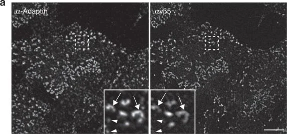 Immunocytochemistry/ Immunofluorescence - Anti-alpha Adaptin antibody [AC1-M11] (AB2807)