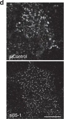 Immunocytochemistry/ Immunofluorescence - Anti-alpha Adaptin antibody [AC1-M11] (AB2807)