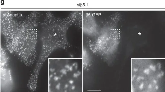 Immunocytochemistry/ Immunofluorescence - Anti-alpha Adaptin antibody [AC1-M11] (AB2807)