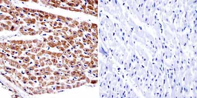 Immunohistochemistry (Formalin/PFA-fixed paraffin-embedded sections) - Anti-alpha Adaptin antibody [AC1-M11] (AB2807)