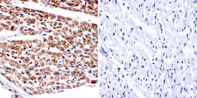 Immunohistochemistry (Formalin/PFA-fixed paraffin-embedded sections) - Anti-alpha Adaptin antibody [AC1-M11] (AB2807)